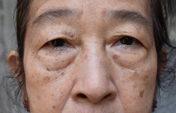 Wajah Wanita Tua Asia Tenggara Konsep Penuaan — Stok Foto