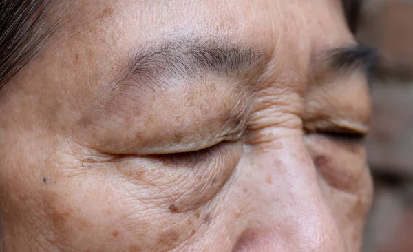Falten Das Geschlossene Auge Einer Asiatischen Älteren Frau Nahaufnahme — Stockfoto