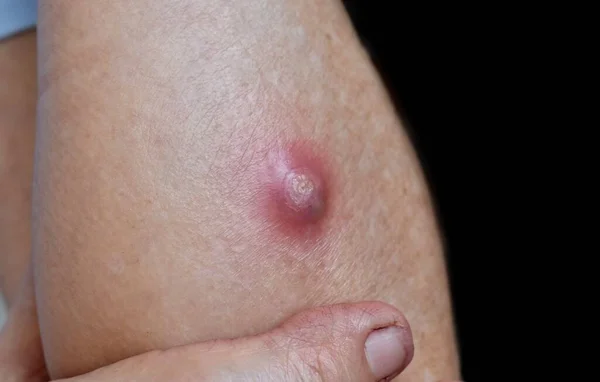 Дәрімен терең минет Әйел порно қыздар порно секс видео