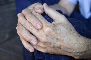 Asyalı yaşlı Myanmar 'ın ellerini sıktı. Romatoid artrit, osteoartrit veya eklem ağrısı kavramı.