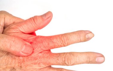 Asyalı yaşlı bir adamın acı dolu sırt görüntüsü. Tendonit ve el kasları ağrısı..