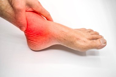 Ayak ve ayak eklemlerinde iltihap var. Eklem ağrısı ve bacak sorunları kavramı. Beyazda izole edilmiş.