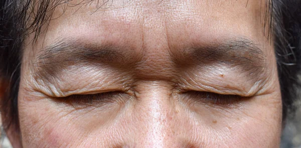 Rugas Torno Olho Fechado Homem Mais Velho Asiático Vista Perto — Fotografia de Stock