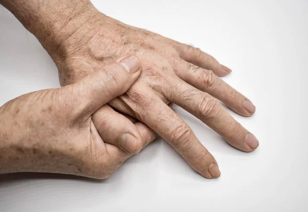 Hands Southeast Asian Elder Man Concept Hand Pain Arthritis Finger Royalty Free Stock Photos