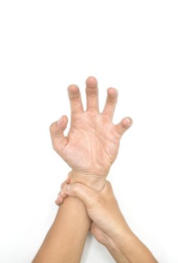 Asyalı bir gencin üst bacağında Volkmann kasılması. El, el, parmak ve bilek pençe benzeri bir duruş oluşturan ön kol kaslarının sürekli kısaltılmasıdır..
