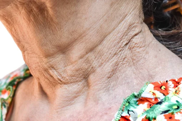 Aging Skin Folds Skin Creases Wrinkles Southeast Asian Chinese Old — стоковое фото