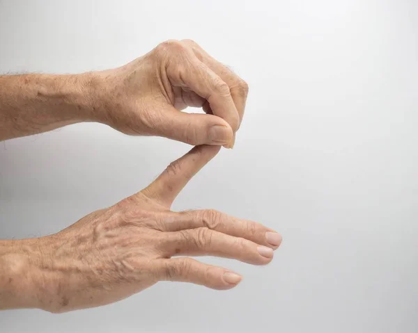 Strengthening Exercise Finger Health Asian Elder Male Patient Muscle Spasm —  Fotos de Stock