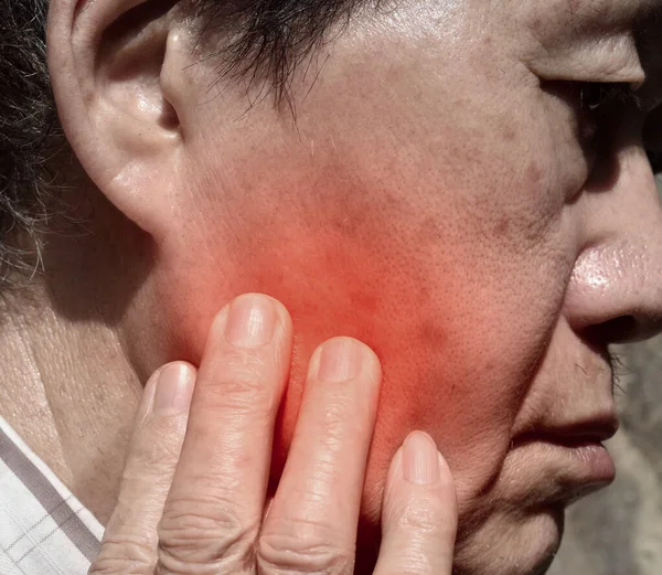 Inflamación Mejilla Paciente Asiático Siente Dolor Muelas Sabio Mandíbula Tierna —  Fotos de Stock
