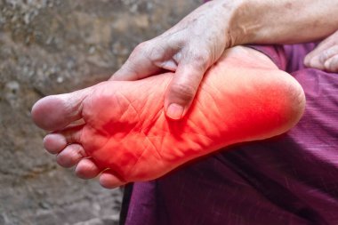 Diyabet hastası Asyalı yaşlı adamın ayağında karıncalanma ve yanma hissi. Ayak ağrısı. Duyusal nöropati sorunları. Ayak sinirleri problemleri. Plantar fasiiti..