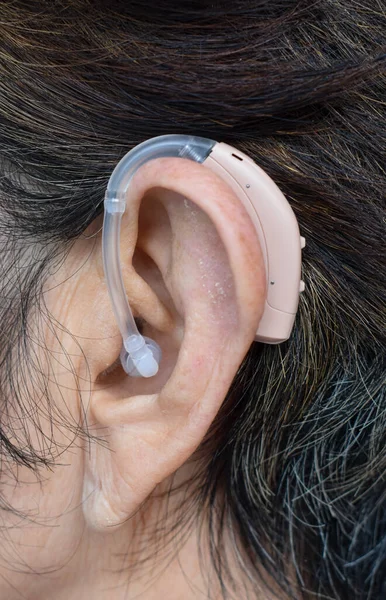 Electronic hearing aid device in the ear of Asian old woman with total deafness.