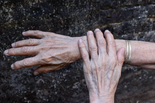 Asyalı Yaşlı Kadının Yaşlı Elleri Romatoid Eklem Iltihabı Osteoartrit Bilek — Stok fotoğraf