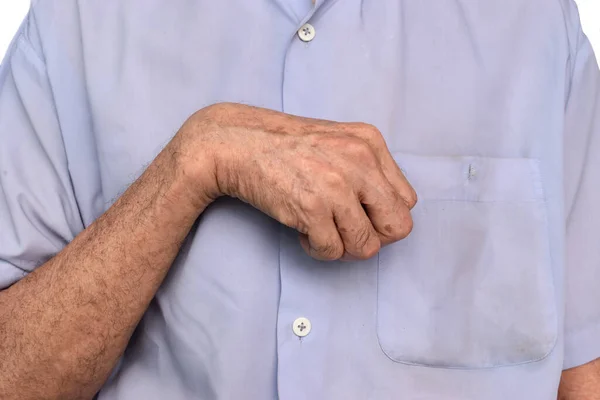 Steifigkeit Der Handmuskulatur Und Beweglichkeit Der Finger Eines Asiatischen Älteren — Stockfoto