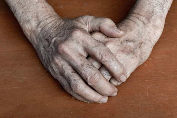 Mano Del Anciano Del Sudeste Asiático Concepto Artritis Reumatoide Osteoartritis —  Fotos de Stock