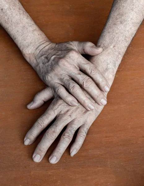 Hand Eines Südostasiatischen Älteren Mannes Konzept Der Rheumatoiden Arthritis Arthrose — Stockfoto