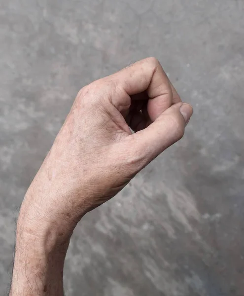 Steifigkeit Der Handmuskulatur Und Beweglichkeit Der Finger Eines Asiatischen Älteren — Stockfoto