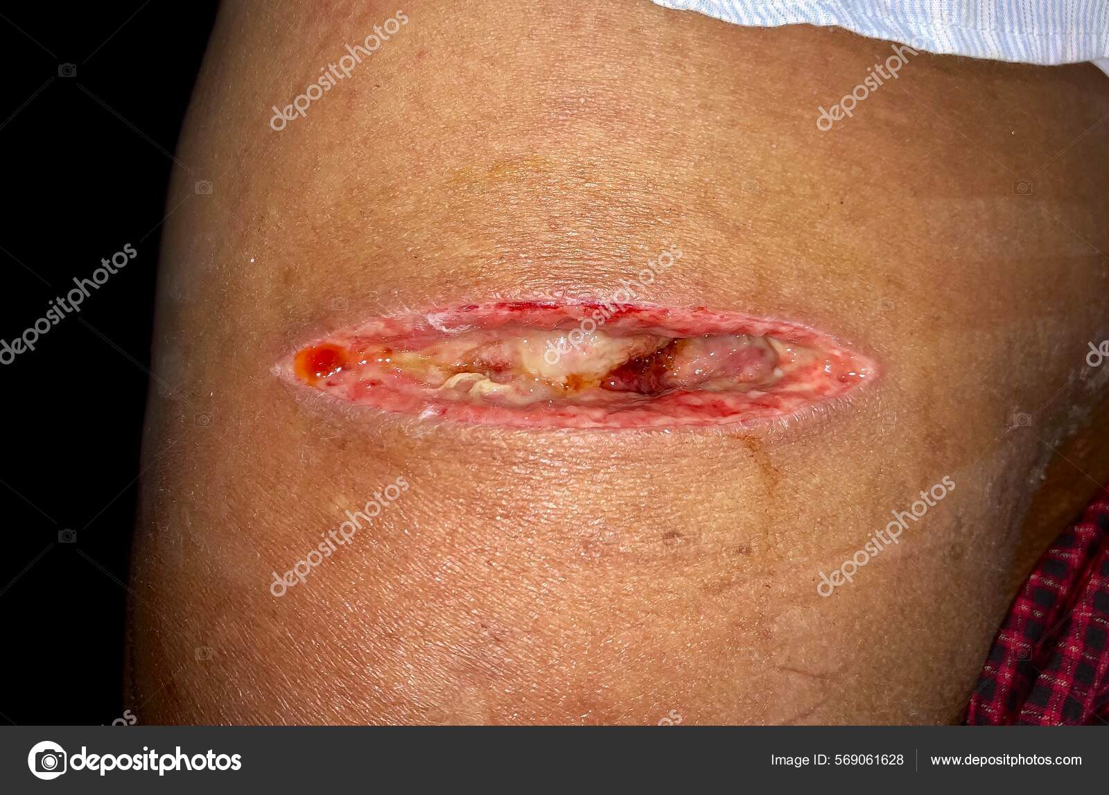 Pediatra Carla - MOLLUSCO CONTAGIOSO Contagioso e…... | Facebook, image size:1600x1147