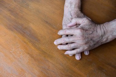 Güneydoğu Asyalı yaşlı adamın eli. Romatoid artrit, osteoartrit veya eklem ağrısı kavramı.