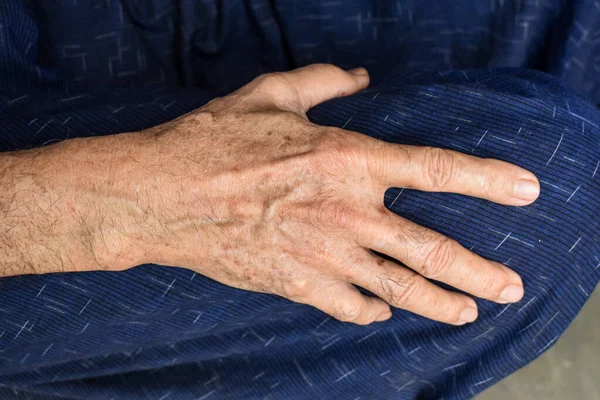 Hand of Southeast Asian elder man. Concept of rheumatoid arthritis, osteoarthritis, or joint pain.