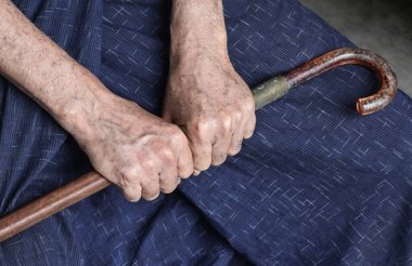 Güneydoğu Asyalı yaşlı adamın eli. Romatoid artrit, osteoartrit veya eklem ağrısı kavramı.
