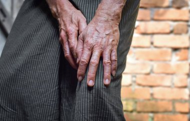 Asyalı Myanmar 'ın yaşlı adamında eklem ağrısı. Kemik iltihabı, romatizma artrit, dizkapağı tendoniti, predizellar bursitis, yan bağ zedelenmesi veya fırıncı kisti..