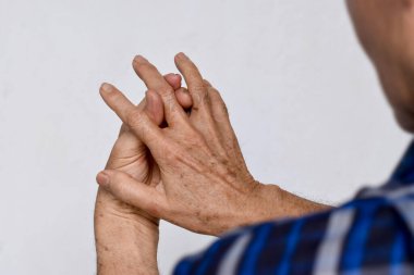 Orta parmak ve el, Asyalı yaşlı adamın iltihabı. Kireçlenme ve parmak problemi kavramı.
