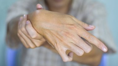 Asyalı genç adamın Ulnar pençesi. Ayrıca evde kalmış pençe olarak da bilinir. Kol kemiği zedelenmesi, bel kemiğinin zayıflamasına neden olur..