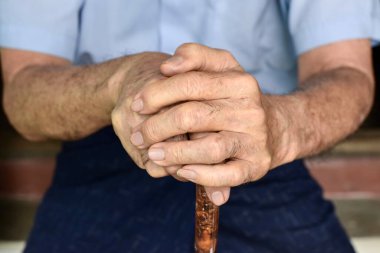 Güneydoğu Asyalı yaşlı adamın eli. Romatoid artrit, osteoartrit veya eklem ağrısı kavramı.