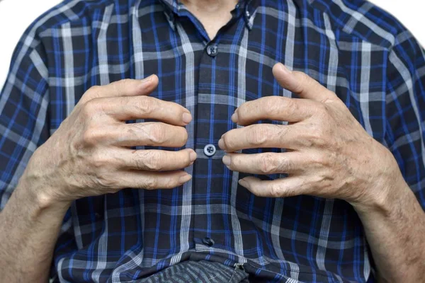 Hand Eines Südostasiatischen Älteren Mannes Konzept Der Rheumatoiden Arthritis Arthrose — Stockfoto