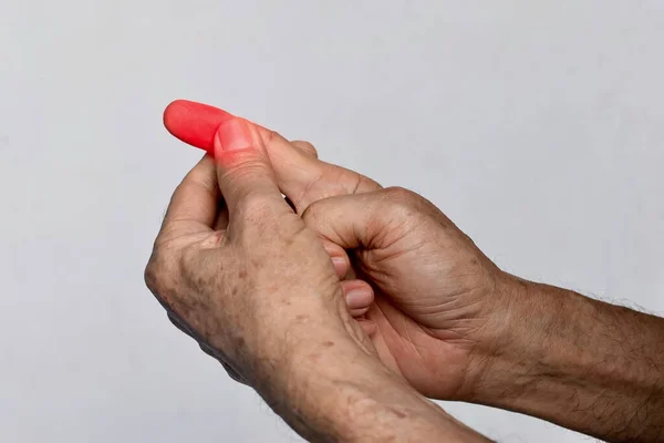 Entzündung Der Fingerkuppe Des Asiatischen Alten Mannes Konzept Von Cellulitis — Stockfoto