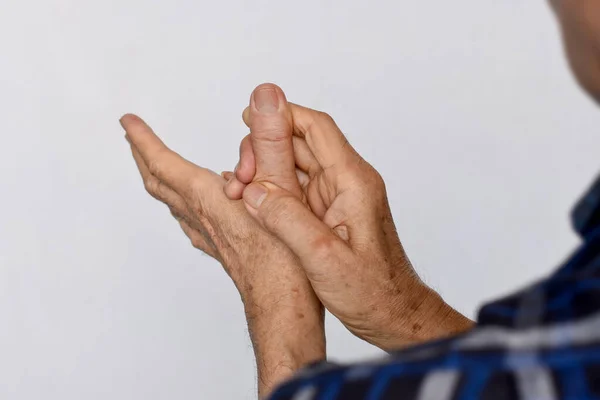 Inflammation of Asian old man thumb and hand. Concept of arthritis and finger problems.