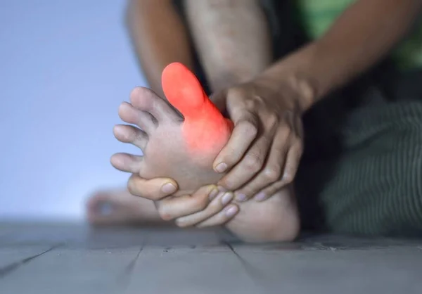Zánět Asijského Mladého Muže Palec Koncepce Bolesti Kloubů Nohou Artritidy — Stock fotografie
