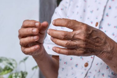Güneydoğu Asyalı yaşlı kadının elleri. Romatoid artrit, osteoartrit veya eklem ağrısı kavramı. El zayıflığı.