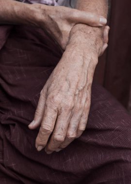 Güneydoğu Asyalı yaşlı adamın eli. Romatoid artrit, osteoartrit veya eklem ağrısı kavramı.