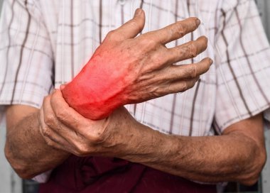 Asyalı ihtiyarın bileğinde iltihap var. Eklem ağrısı veya osteoartrit kavramı.