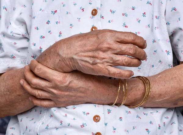 Mãos Mulher Mais Velha Asiática Conceito Artrite Reumatoide Osteoartrite Tensão — Fotografia de Stock