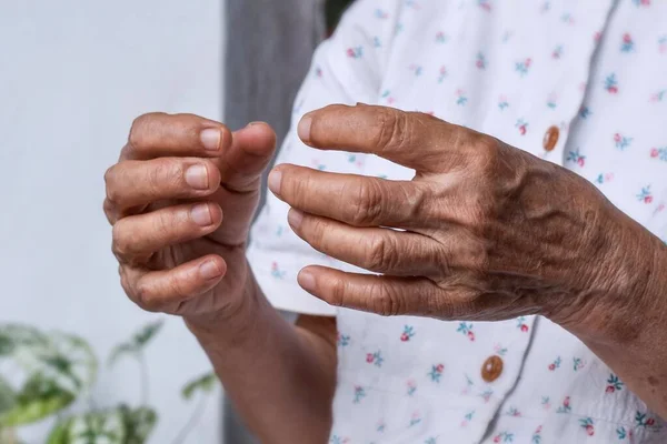 Hands Southeast Asian Elder Woman Concept Rheumatoid Arthritis Osteoarthritis Joint — Stock Photo, Image