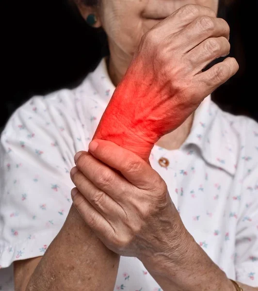 Inflammation of Asian old woman wrist joint. Concept of joint pain and hand problems.