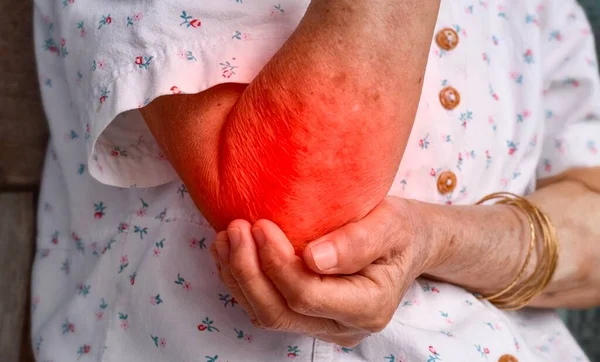 Pain in the elbow joint of Southeast Asian elder woman. Concept of elbow pain, rheumatoid arthritis and arm problems.