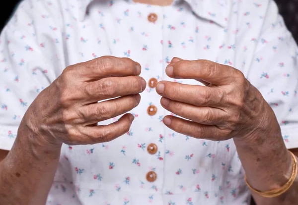 Hands Southeast Asian Elder Woman Concept Rheumatoid Arthritis Osteoarthritis Joint — Stockfoto