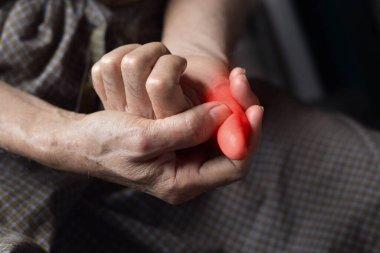 Asyalı yaşlı adamın baş parmağı iltihaplanmış. Acı verici basamak, selülit veya parmak problemi kavramı.