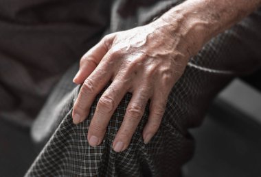 Güneydoğu Asyalı yaşlı adamın eli. Romatoid artrit, osteoartrit veya eklem ağrısı kavramı.