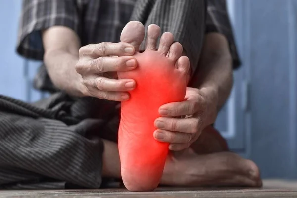 Diyabet hastası Asyalı yaşlı adamın ayağında karıncalanma ve yanma hissi. Ayak ağrısı. Duyusal nöropati sorunları. Ayak sinirleri problemleri. Plantar fasiiti..
