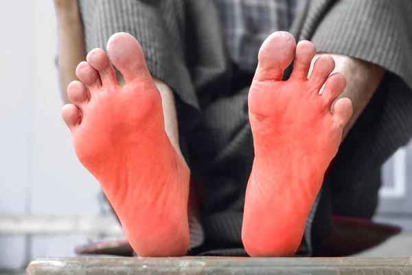 Tingling Burning Sensation Feet Asian Old Man Diabetes Foot Pain — Stock Fotó
