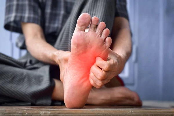 Itchy Foot Skin Asian Elder Man Concept Skin Diseases Scabies — 图库照片