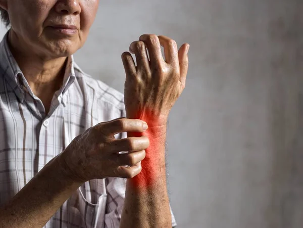 Asian Elder Man Scratching His Forearm Concept Itchy Skin Diseases — Stock Photo, Image