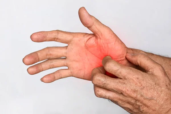 Asian Elder Man Scratching His Hand Concept Itchy Skin Diseases —  Fotos de Stock