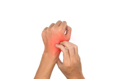 Asian young man scratching his hand. Concept of itchy skin diseases such as scabies, fungal infection, eczema, psoriasis, allergy, etc.