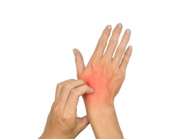 Asian young man scratching his hand. Concept of itchy skin diseases such as scabies, fungal infection, eczema, psoriasis, allergy, etc.