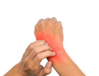 Asian young man scratching his hand. Concept of itchy skin diseases such as scabies, fungal infection, eczema, psoriasis, allergy, etc.