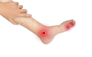 Ayak eklemleri iltihaplanmış. Romatoid eklem iltihabı, poliartrit, gut, ayak parmağı eklem şişmesi ya da eklem ağrısı kavramı..